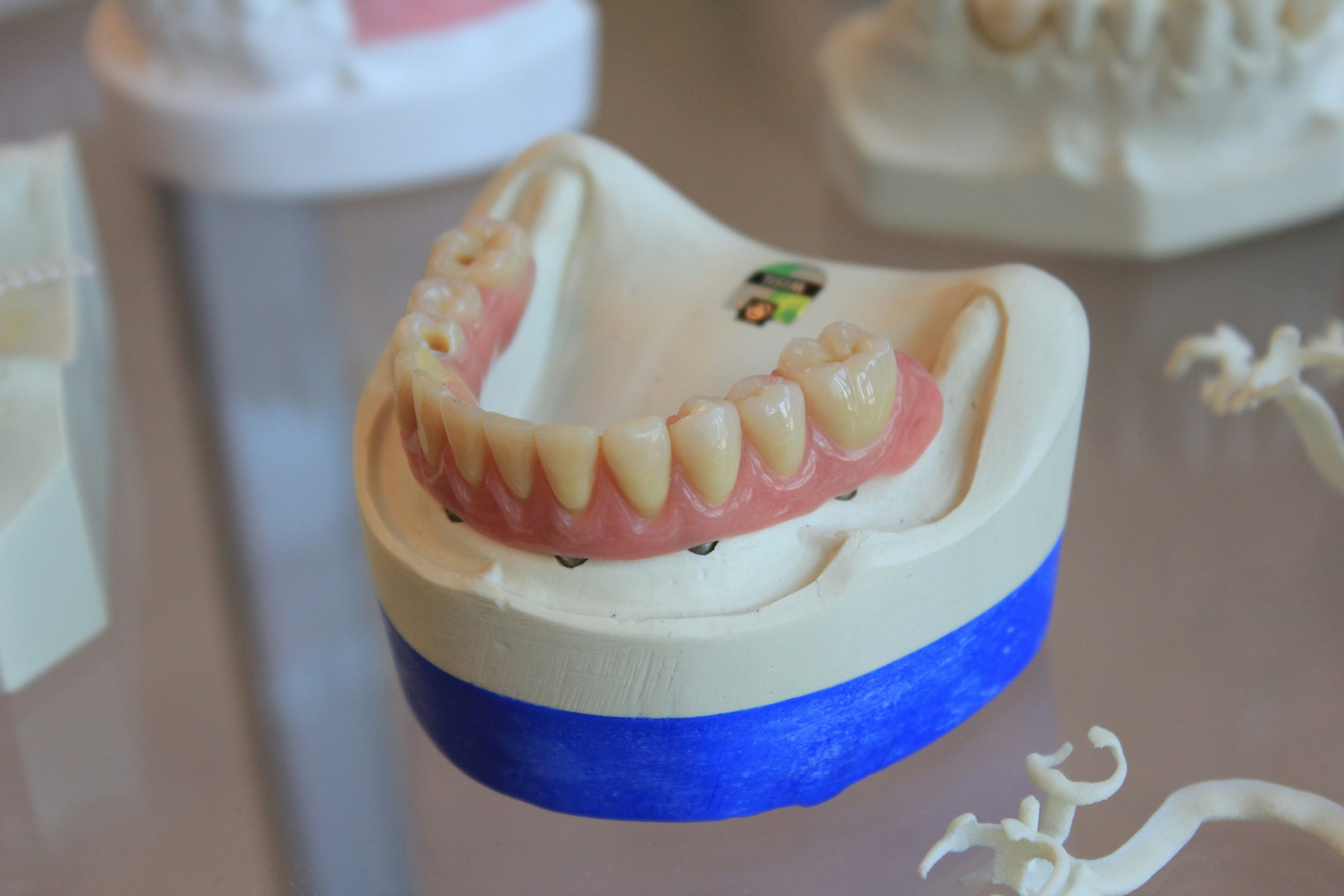 Prothèse dentaire